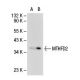 MTHFD2 Antibody (243.1) - Western Blotting - Image 30070