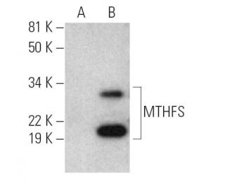 MTHFS Antibody (D-11) - Western Blotting - Image 290016