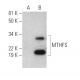 MTHFS Antibody (D-11) - Western Blotting - Image 290016