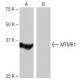 MTMR1 Antibody (1B9) - Western Blotting - Image 65009