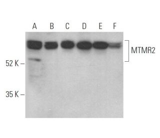 MTMR2 Antibody (B-6) - Western Blotting - Image 371997 