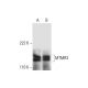 MTMR3 Antibody (A-12) - Western Blotting - Image 299253 