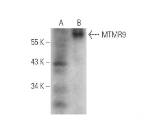 MTMR9 Antibody (H-1) - Western Blotting - Image 319914 