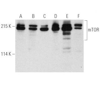 western blotting image from recommended mTOR (30) monoclonal antibody replacement. Image 390045