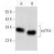 Questo anticorpo policlonale è stato sospeso. Consulta il nostro anticorpo monoclonale <a href="mttfa-antibody-c-9">mtTFA (C-9)</a> raccomandato (sono riportati i dati del campione). western blotting image from recommended mtTFA (C-9) monoclonal antibody replacement. Image 354318