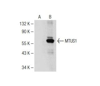 MTUS1 Antibody (31-Y) - Western Blotting - Image 149969 