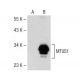 MTUS1 Antibody (31-Y) - Western Blotting - Image 149967