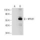 MTUS1 Antibody (31-Y) - Western Blotting - Image 149969 