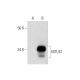 MTUS1 Antibody (E-8) - Western Blotting - Image 292102