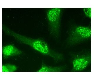 µ-crystallin Antibody (F-11) | SCBT - Santa Cruz Biotechnology