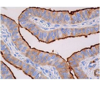 Mucin 1/MUC1 Antibody (0.N.272) - Immunohistochemistry - Image 361350 