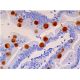 immunohistochemistry image from recommended Mucin 2/MUC2 (F-2) monoclonal antibody replacement. Image 359495