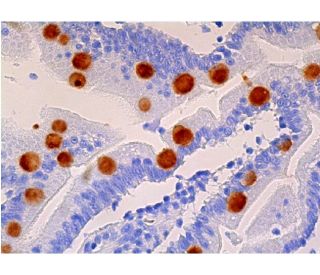 immunohistochemistry image from recommended Mucin 2/MUC2 (F-2) monoclonal antibody replacement. Image 359495