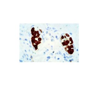 Mucin 3/MUC3 Antibody (M3.1) - Immunohistochemistry - Image 5293 