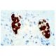 Mucin 3/MUC3 Antibody (M3.1) - Immunohistochemistry - Image 5293 