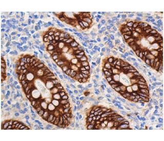 Mucin 4/MUC4 Antibody (8G7) - Immunohistochemistry - Image 358533 