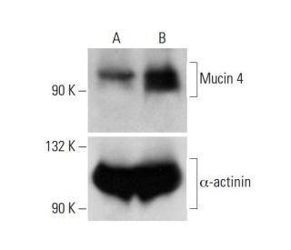 Mucin 4 CRISPR Activation Plasmid (h): sc-400329-ACT. Western blot analysis... 