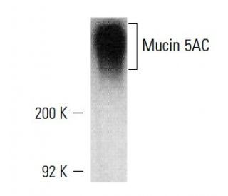 western blotting image from recommended Mucin 5AC/MUC5AC (45M1) monoclonal antibody replacement. Image 6715
