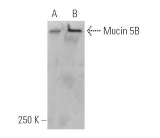 western blotting image from recommended Mucin 5B/MUC5B (5B#19-2E) monoclonal antibody replacement. Image 5301