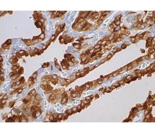 Mucin 6/MUC6 Antibody (CLH5) - Immunohistochemistry - Image 381685 
