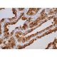 immunohistochemistry image from recommended Mucin 6/MUC6 (CLH5) monoclonal antibody replacement. Image 381685