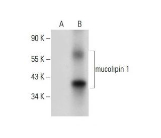 mucolipin 1 Antibody (F-10) - Western Blotting - Image 309705