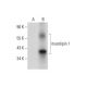 mucolipin 1 Antibody (F-10) - Western Blotting - Image 309705