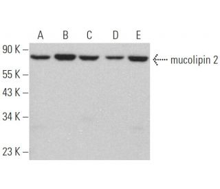 mucolipin 2 Antibody (F-1) - Western Blotting - Image 368339 
