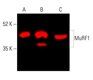 メルけろ様確認用です MuRF1抗体(C-11) | SCBT - Santa Cruz Biotechnology