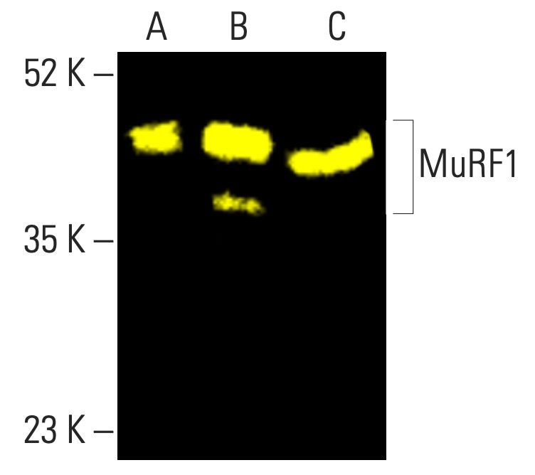 MuRF1抗体(C-11) | SCBT - Santa Cruz Biotechnology