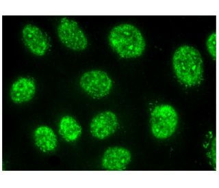 immunofluorescence image from recommended MuRF1 (C-11) monoclonal antibody replacement. Image 323477