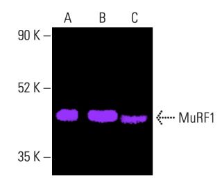 MuRF1 Antibody (C-11) - Western Blotting - Image 403394