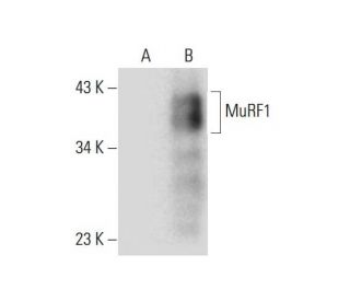 MuRF1 (C-11): sc-398608. Western blot analysis of MuRF1 expression in... 