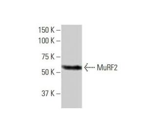 MuRF2 Antibody (1A1) - Western Blotting - Image 352221 