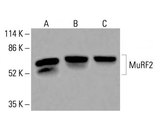 MuRF2 Antibody (1A1) - Western Blotting - Image 416136 