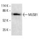 MUS81 Antibody (2G10/3) - Western Blotting - Image 412558