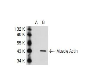 Muscle Actin Antibody (4i346) - Western Blotting - Image 39590 