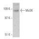 MuSK Antibody (1-YD2) - Western Blotting - Image 368250