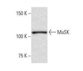 western blotting image from recommended MuSK (1-YD2) monoclonal antibody replacement. Image 65012