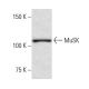 western blotting image from recommended MuSK (1-YD2) monoclonal antibody replacement. Image 65012