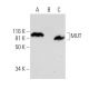 MUT Antibody (D-1) - Western Blotting - Image 291855 