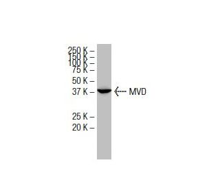 MVD Antibody (2B5) - Western Blotting - Image 33932 
