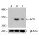Anticorpo MVK (D-3): sc-390669. Análise por Western blot da expressão de MVK em lisados celulares completos de HCT-116 não tratados (A), HCT-116 tratados quimicamente (B) e HeLa (C). β-Actina (C4): sc-47778 utilizado como controlo de carregamento. Reagente de detecção utilizado: m-IgG Fc BP-HRP: sc-525409. MVK Antibody (D-3) - Western Blotting - Image 415120