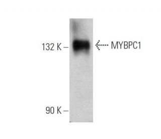 MYBPC1 Antibody (E-6) - Western Blotting - Image 346515