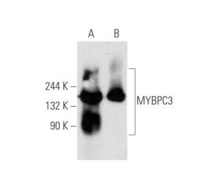 MYBPC3 Antibody (E-7) - Western Blotting - Image 59419 