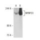 MYBPC3 Antibody (G-2) - Western Blotting - Image 125593 