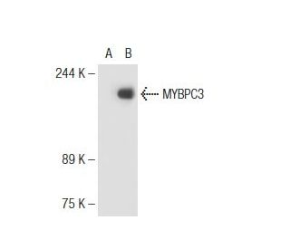 MYBPC3 Antibody (E-7) - Western Blotting - Image 125585