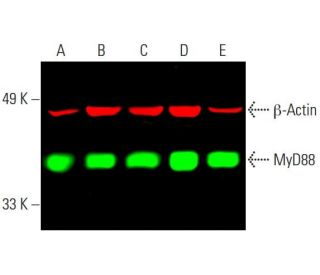 western blotting image from recommended MyD88 (E-11) monoclonal antibody replacement. Image 387068