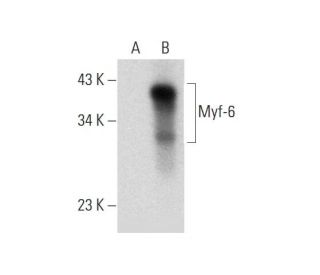 western blotting image from recommended Myf-6 (G-7) monoclonal antibody replacement. Image 318598