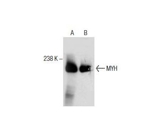 western blotting image from recommended MYH (B-5) monoclonal antibody replacement. Image 286126